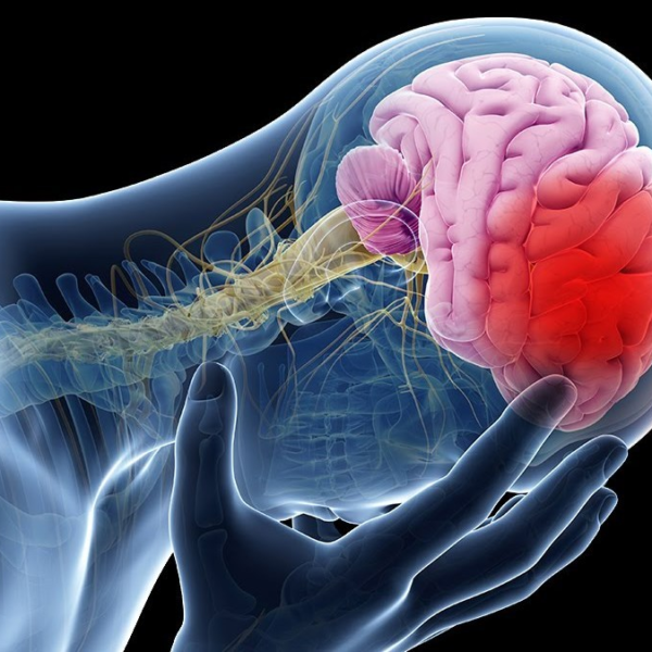 Su Opazo accidente cerebrovascular: soporte de sus fans